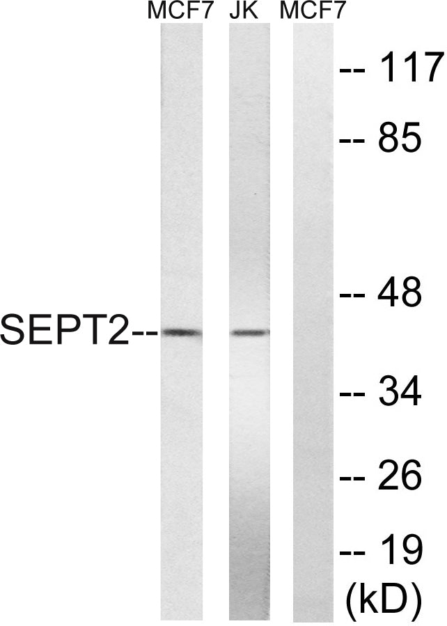 Septin 2 Rabbit Polyclonal Antibody