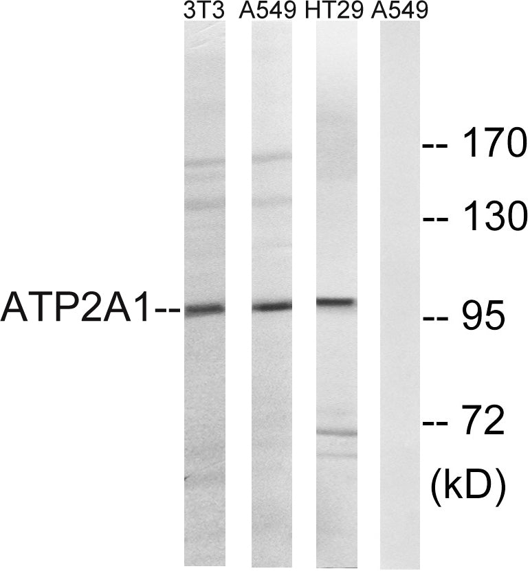 SERCA1 Rabbit Polyclonal Antibody