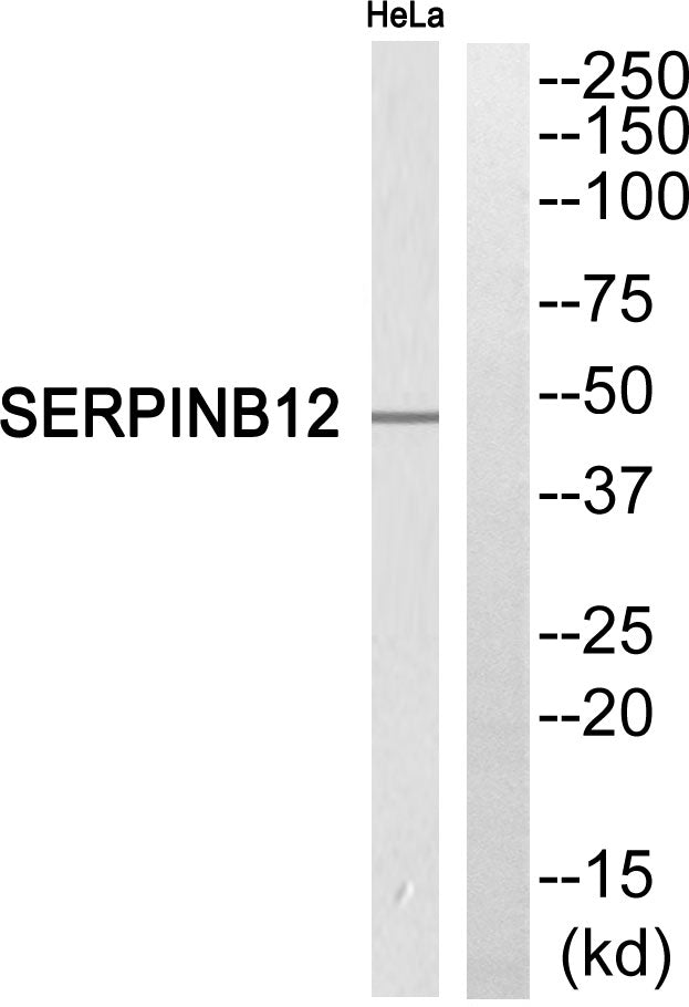 Serpin B12 Rabbit Polyclonal Antibody