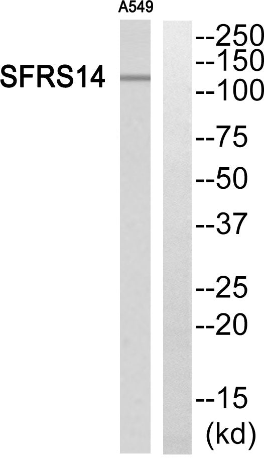 SFRS14 Rabbit Polyclonal Antibody