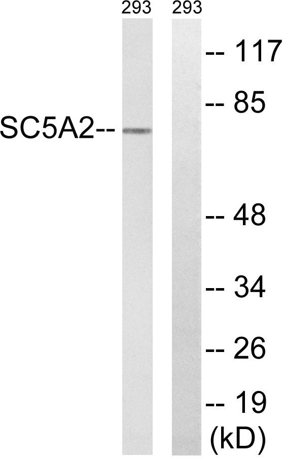 SGLT-2 Rabbit Polyclonal Antibody