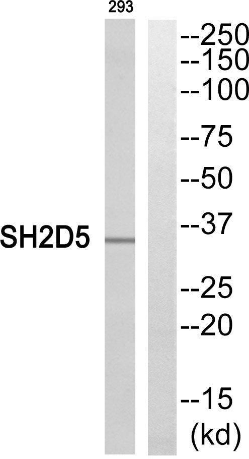 SH2D5 Rabbit Polyclonal Antibody