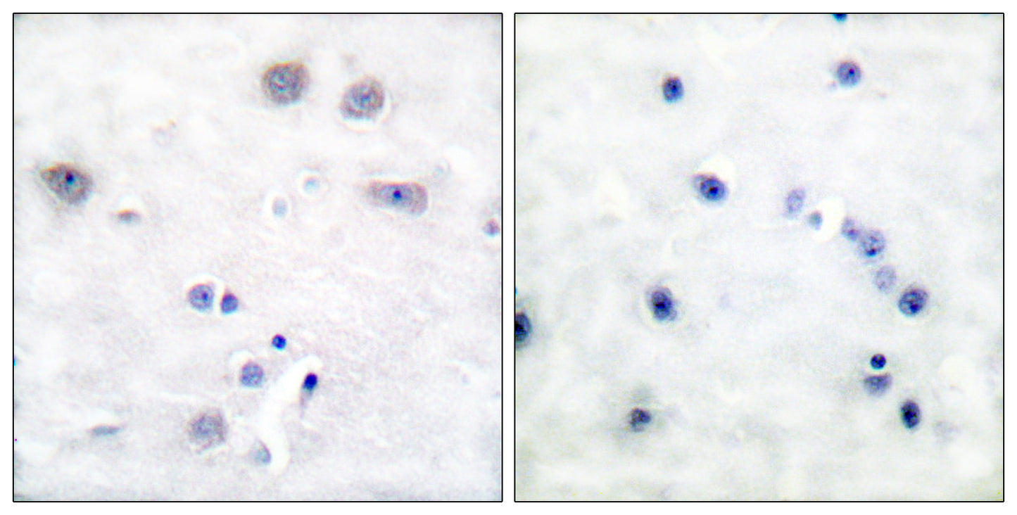 Shc Rabbit Polyclonal Antibody