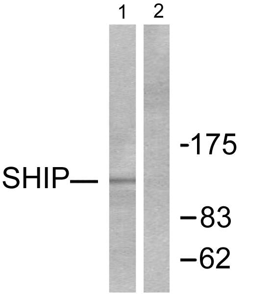 SHIP-1 Rabbit Polyclonal Antibody