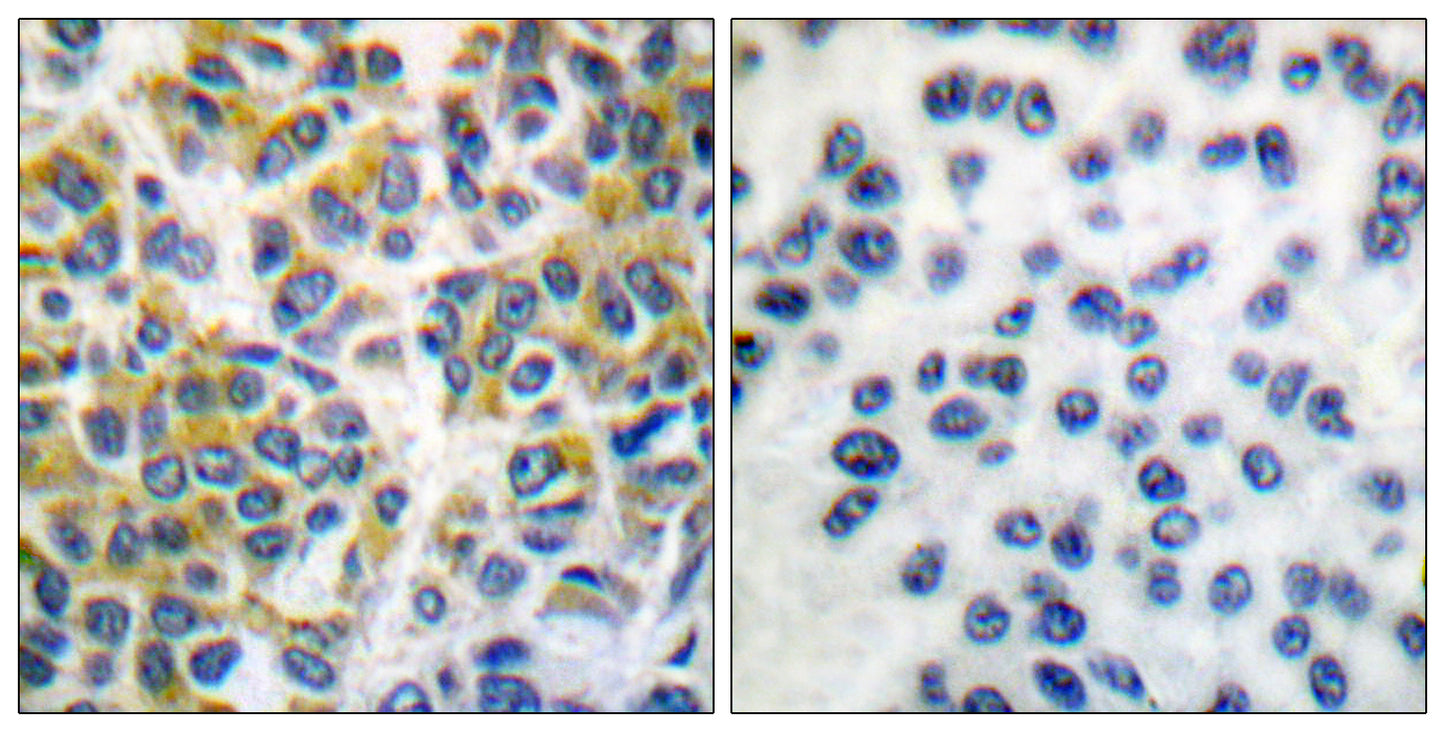 SH-PTP1 Rabbit Polyclonal Antibody