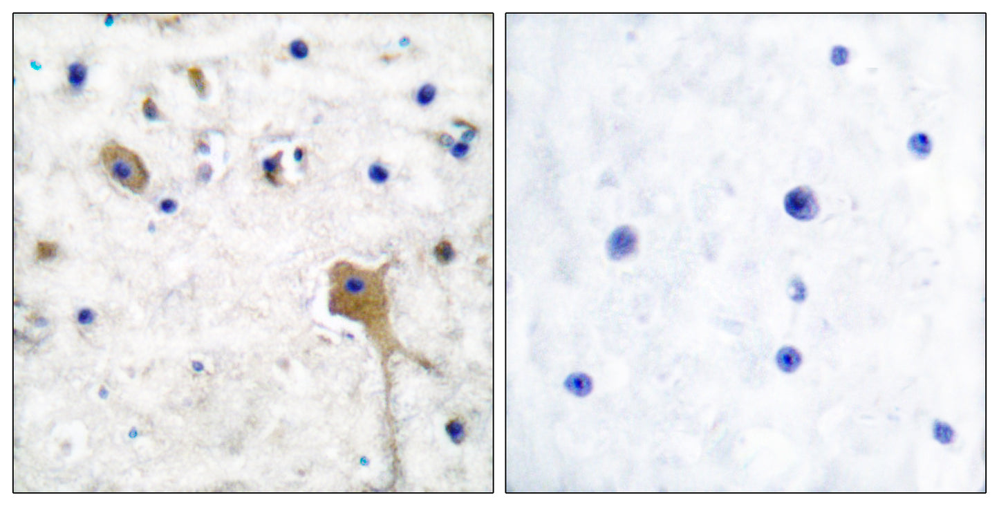 SH-PTP2 Rabbit Polyclonal Antibody