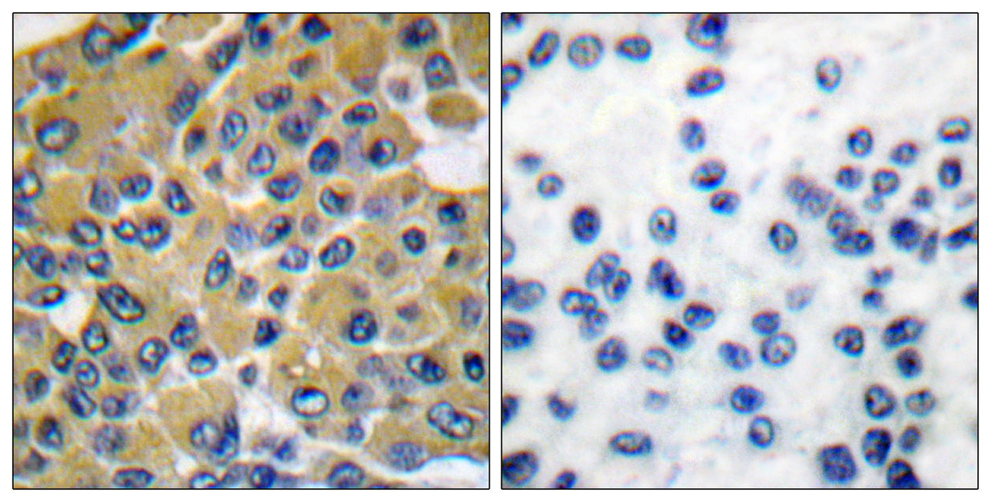 SH-PTP2 Rabbit Polyclonal Antibody