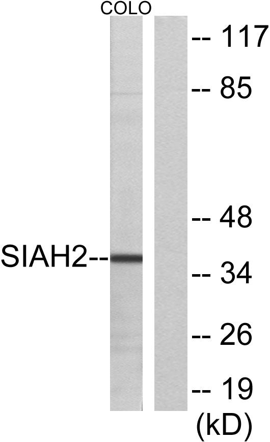 Siah-2 Rabbit Polyclonal Antibody