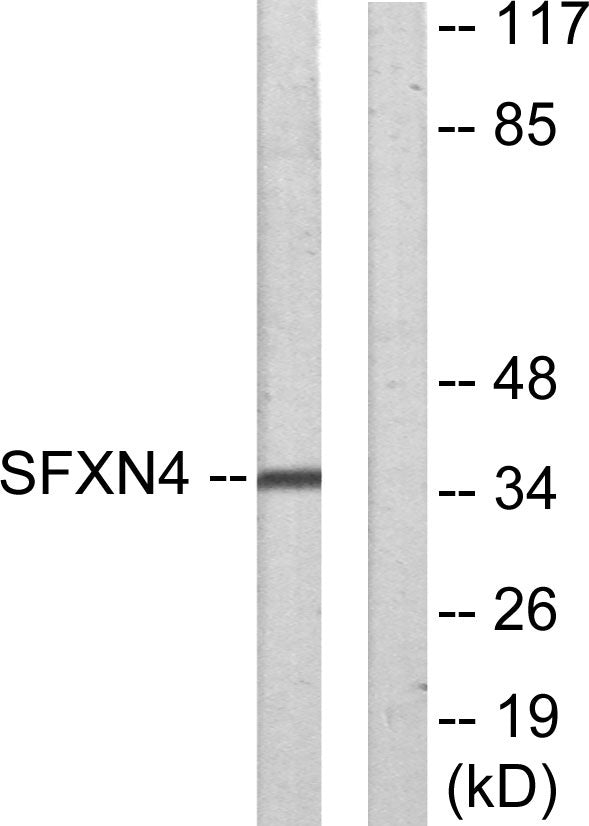 Sideroflexin-4 Rabbit Polyclonal Antibody
