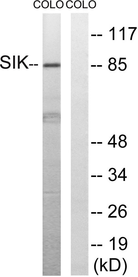 SIK1 Rabbit Polyclonal Antibody