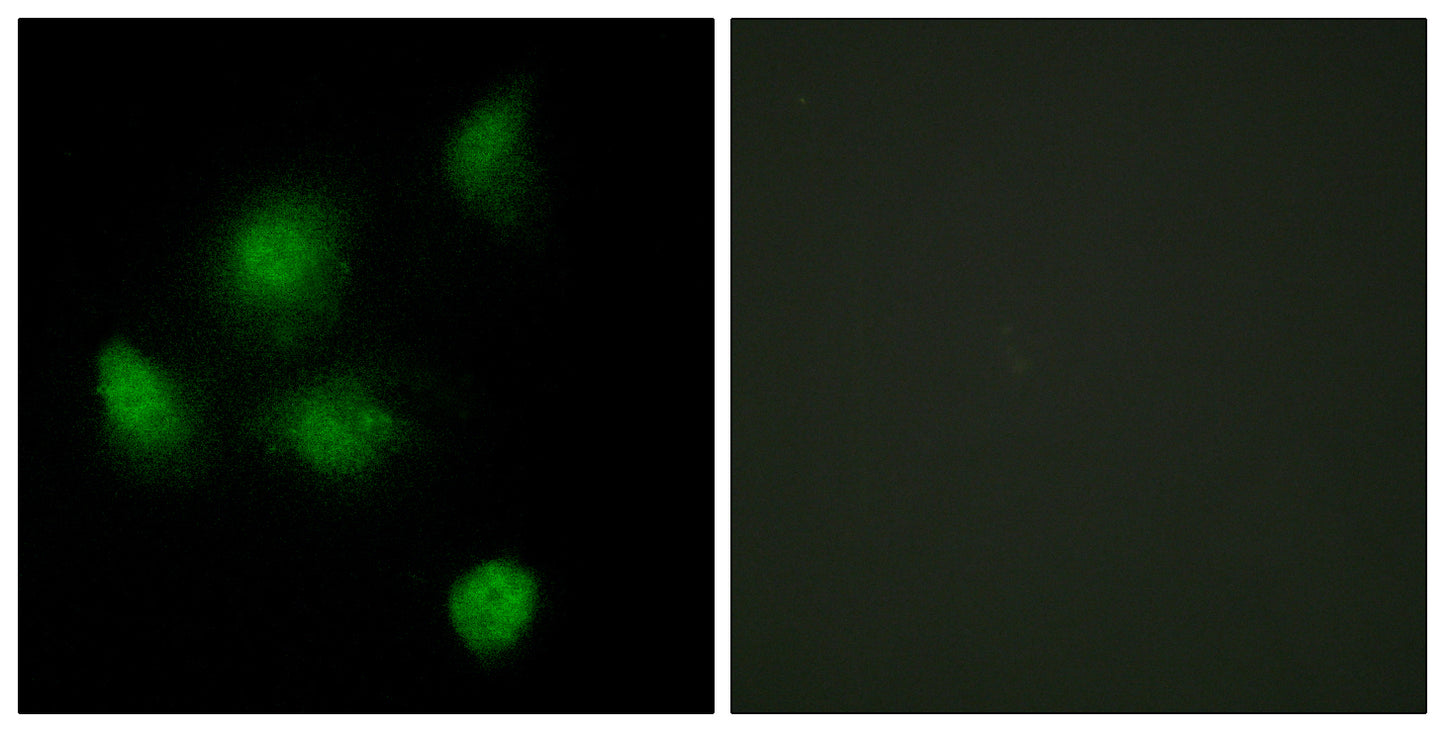 Sin3B Rabbit Polyclonal Antibody