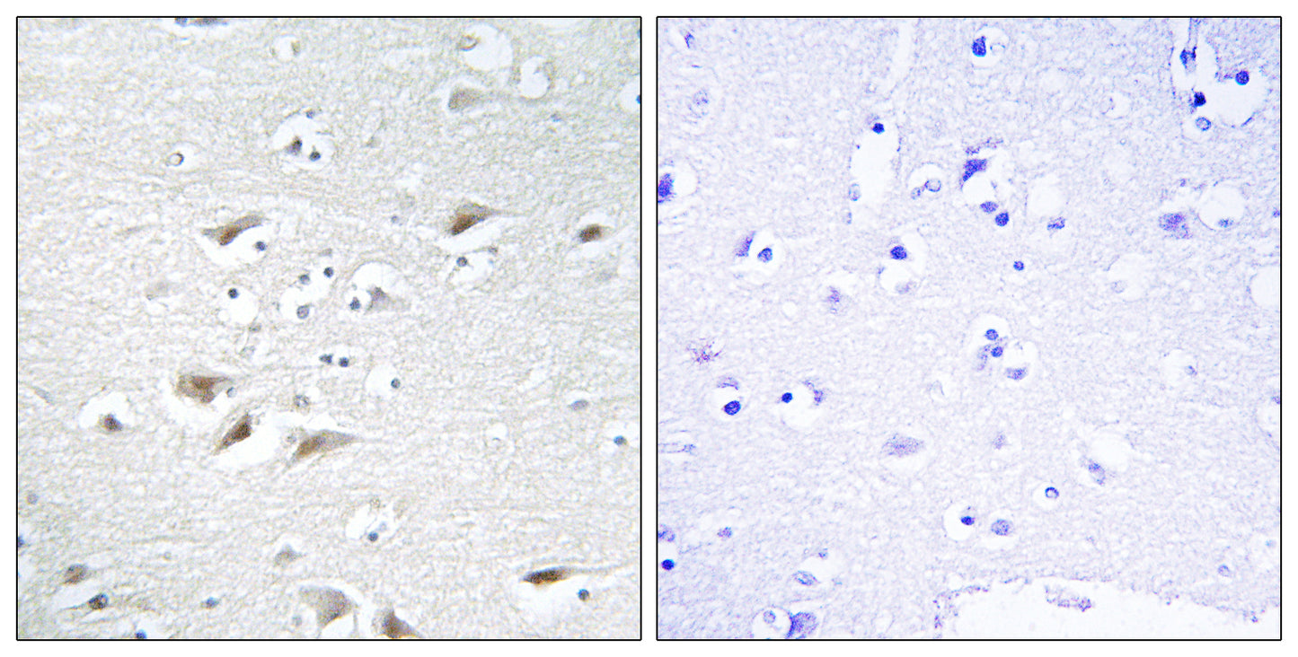 SIP1 Rabbit Polyclonal Antibody