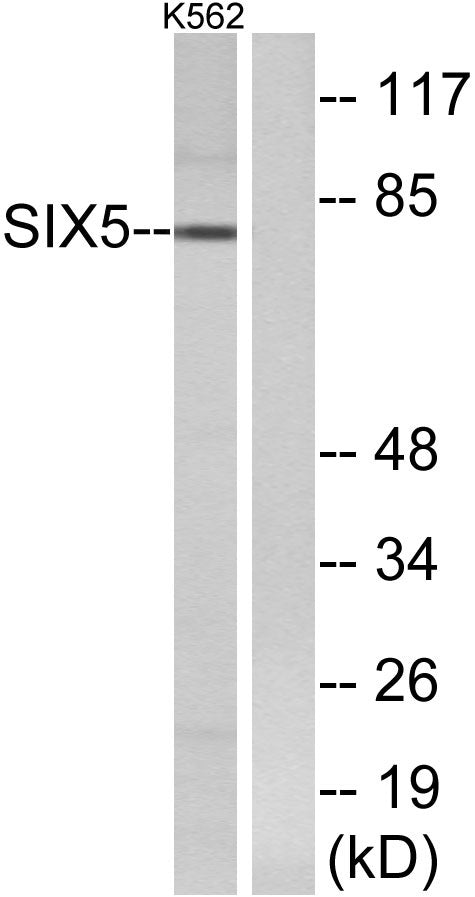 Six5 Rabbit Polyclonal Antibody