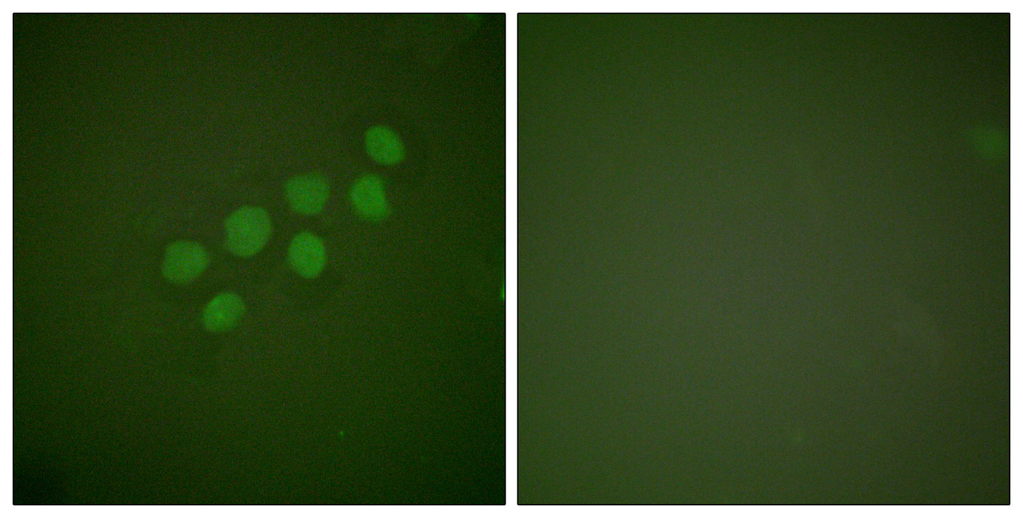 Skp2 p45 Rabbit Polyclonal Antibody