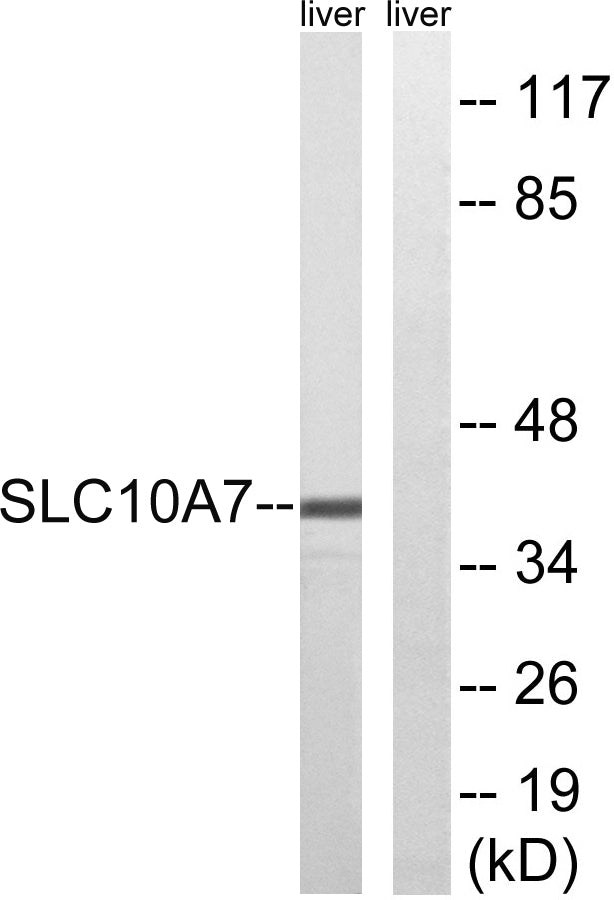 SLC10A7 Rabbit Polyclonal Antibody