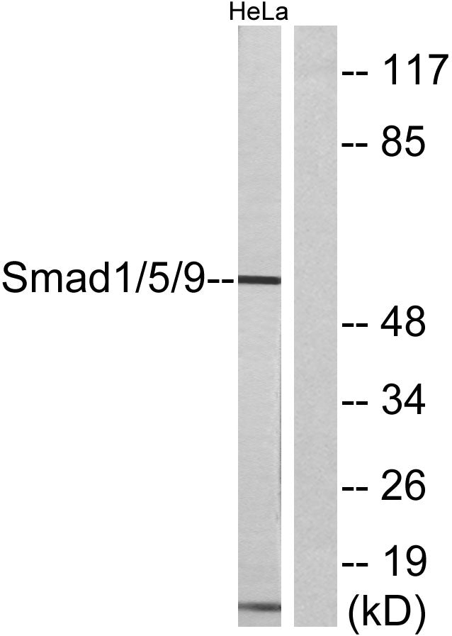 Smad1/5/9 Rabbit Polyclonal Antibody