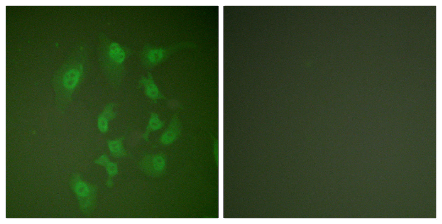 Smad2 Rabbit Polyclonal Antibody