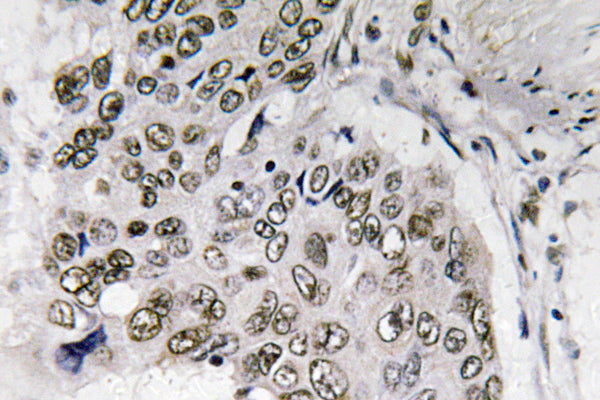 Smad6 Rabbit Polyclonal Antibody