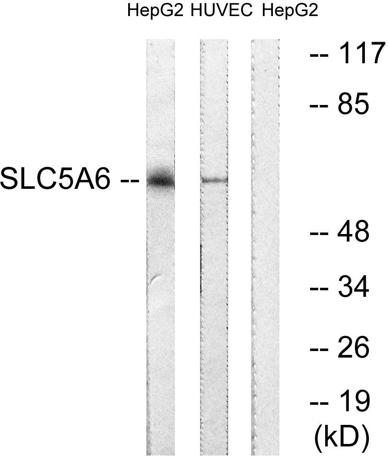 SMVT Rabbit Polyclonal Antibody