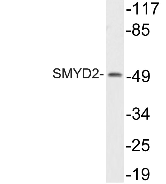 SMYD2 Rabbit Polyclonal Antibody