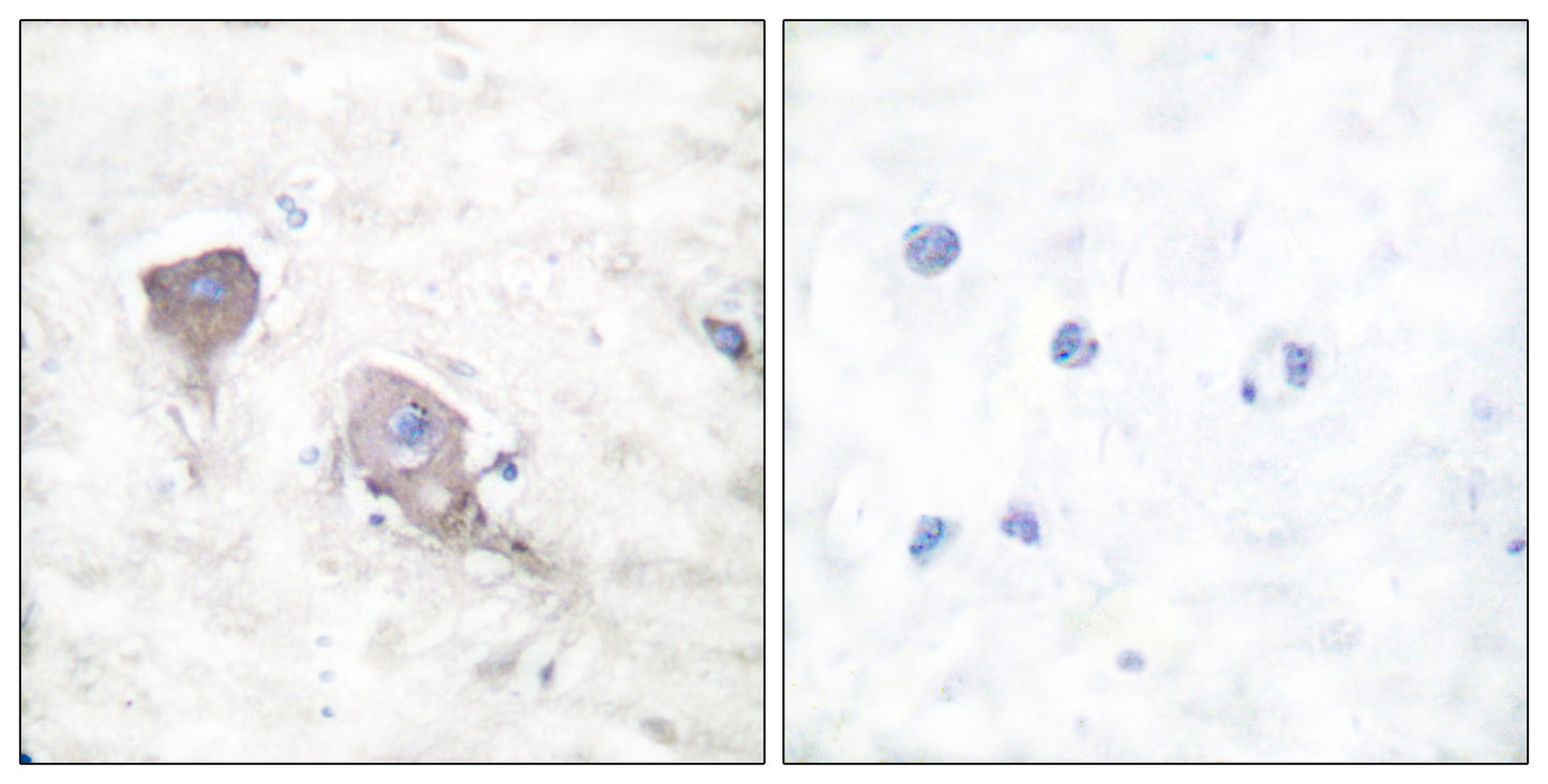 SNAP 25 Rabbit Polyclonal Antibody
