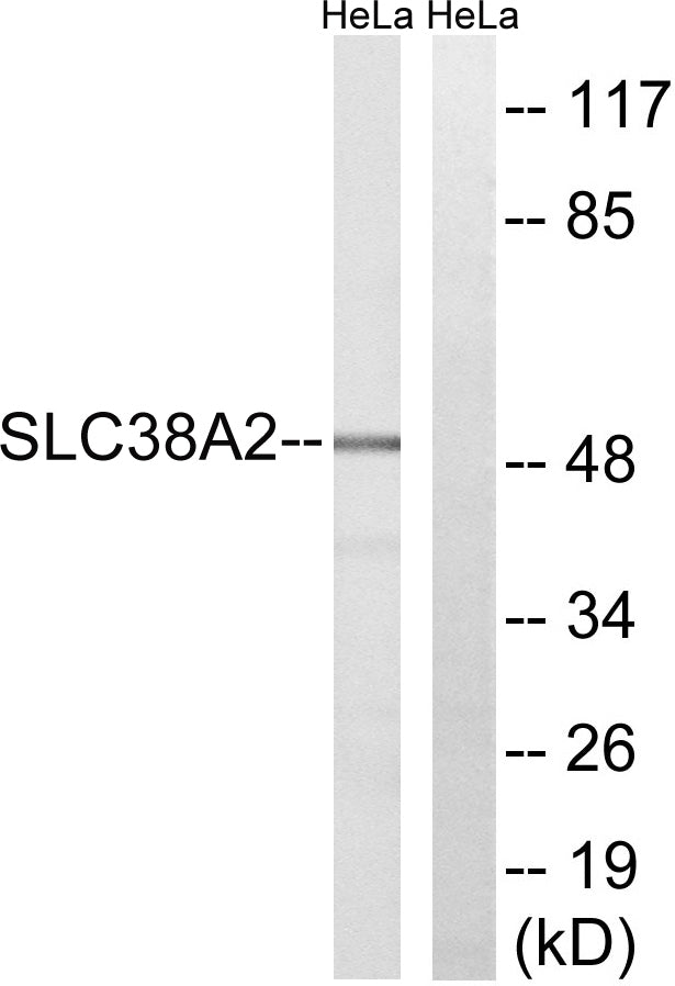 SNAT2 Rabbit Polyclonal Antibody