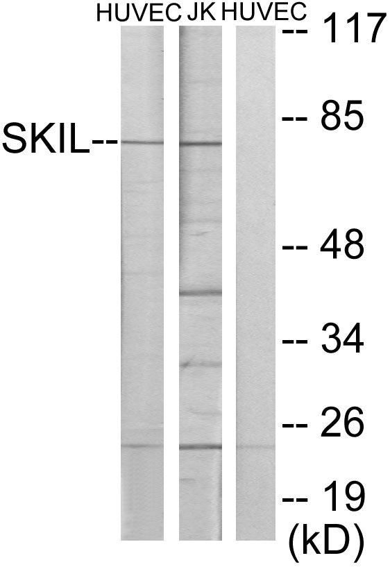 SnoN Rabbit Polyclonal Antibody