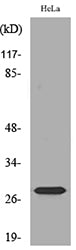 SNRPN Rabbit Polyclonal Antibody