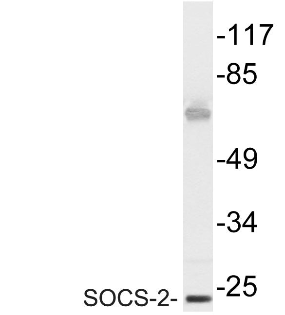 SOCS-2 Rabbit Polyclonal Antibody
