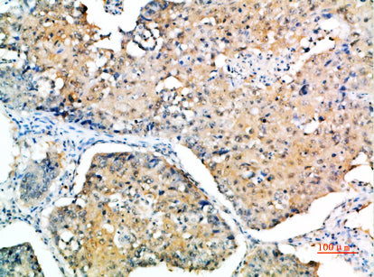 SOCS-3 Rabbit Polyclonal Antibody