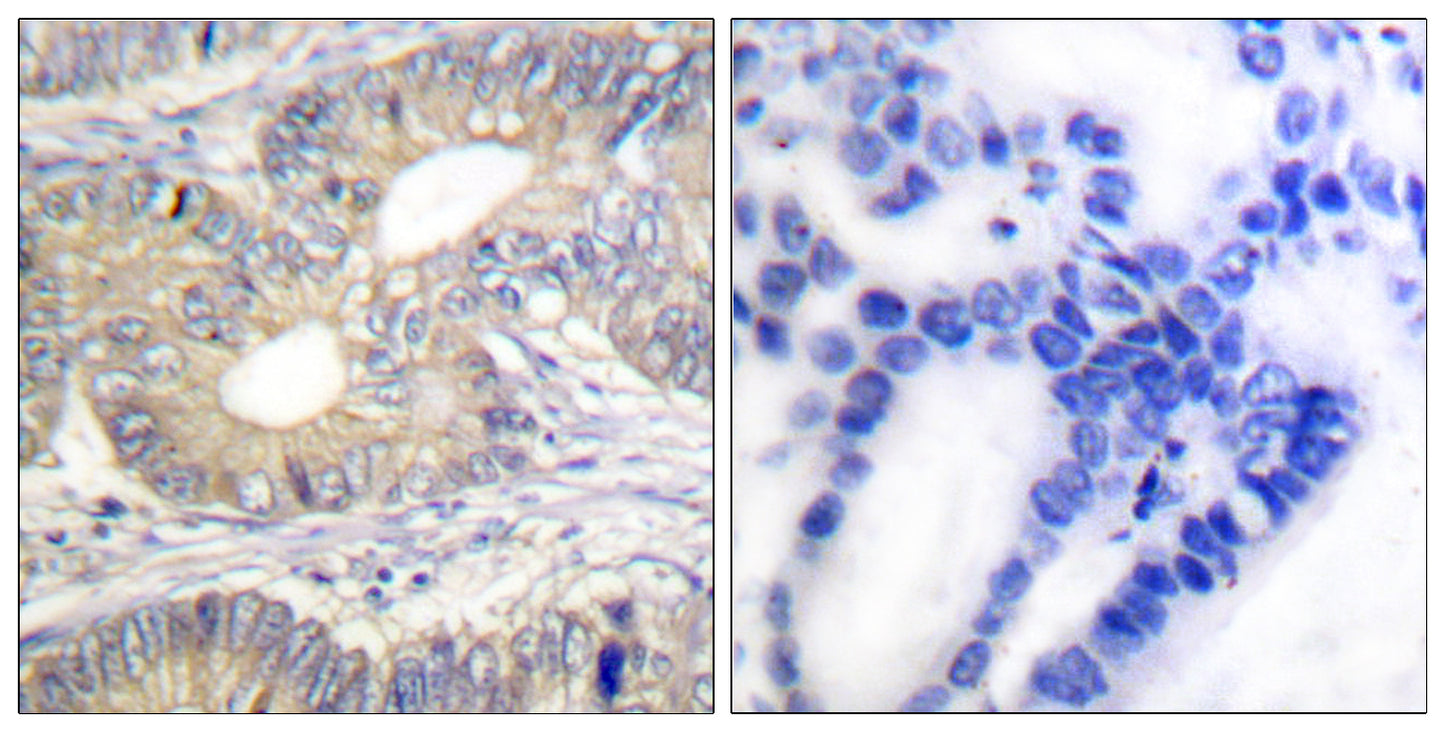 Somatostatin Rabbit Polyclonal Antibody
