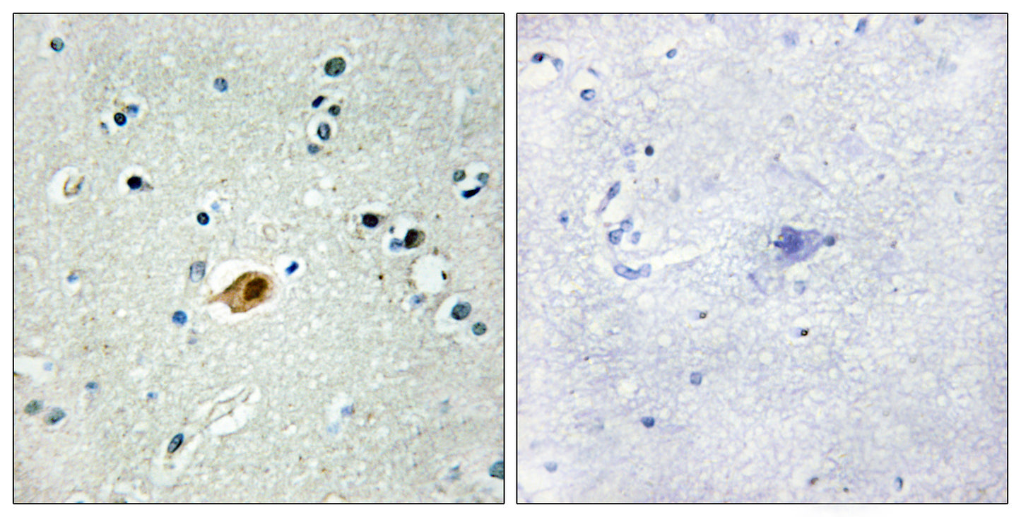 Sox-8/9/17/18 Rabbit Polyclonal Antibody