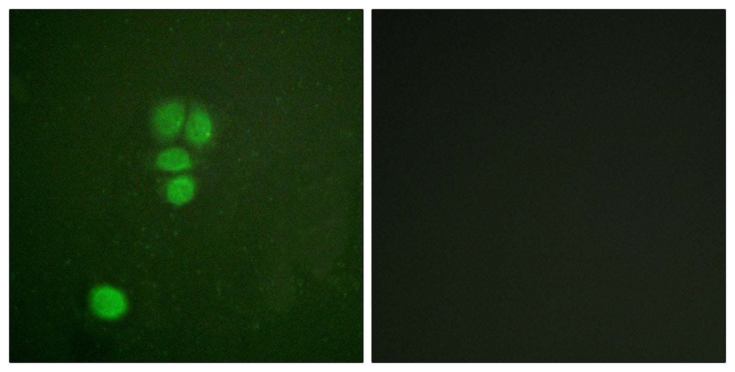 Sox-9 Rabbit Polyclonal Antibody