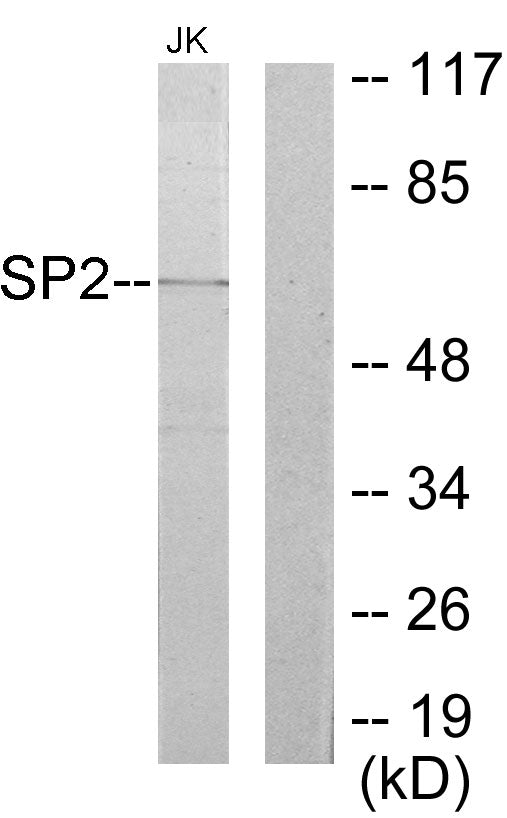 Sp2 Rabbit Polyclonal Antibody