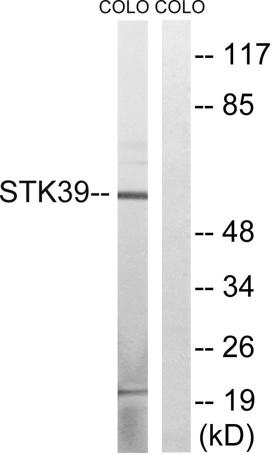 SPAK Rabbit Polyclonal Antibody