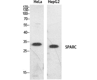 SPARC Rabbit Polyclonal Antibody