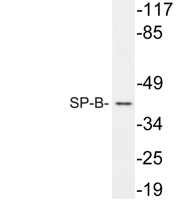 SP-B Rabbit Polyclonal Antibody