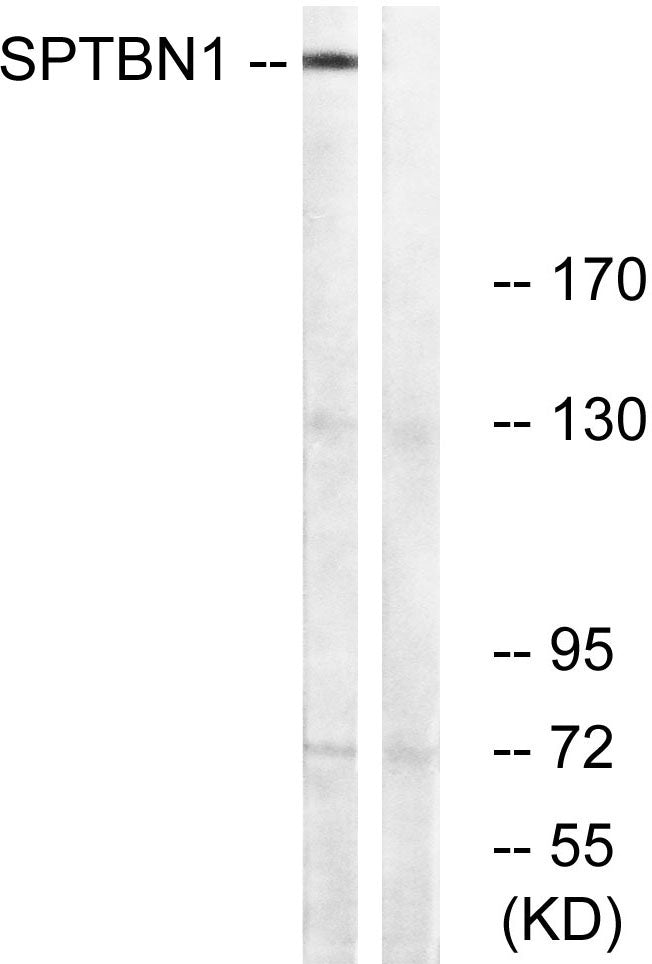 Spectrin β II Rabbit Polyclonal Antibody