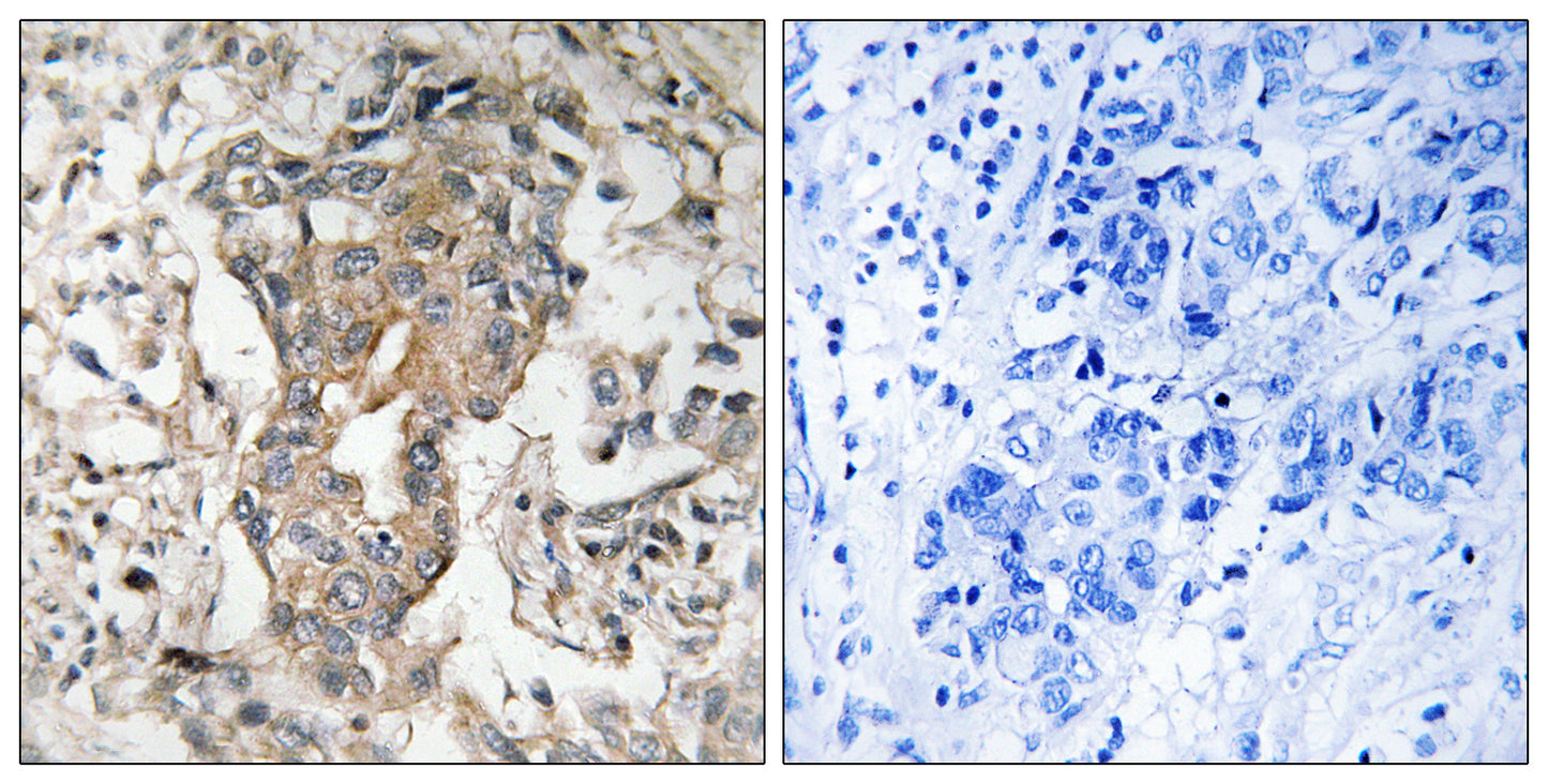 SphK2 Rabbit Polyclonal Antibody