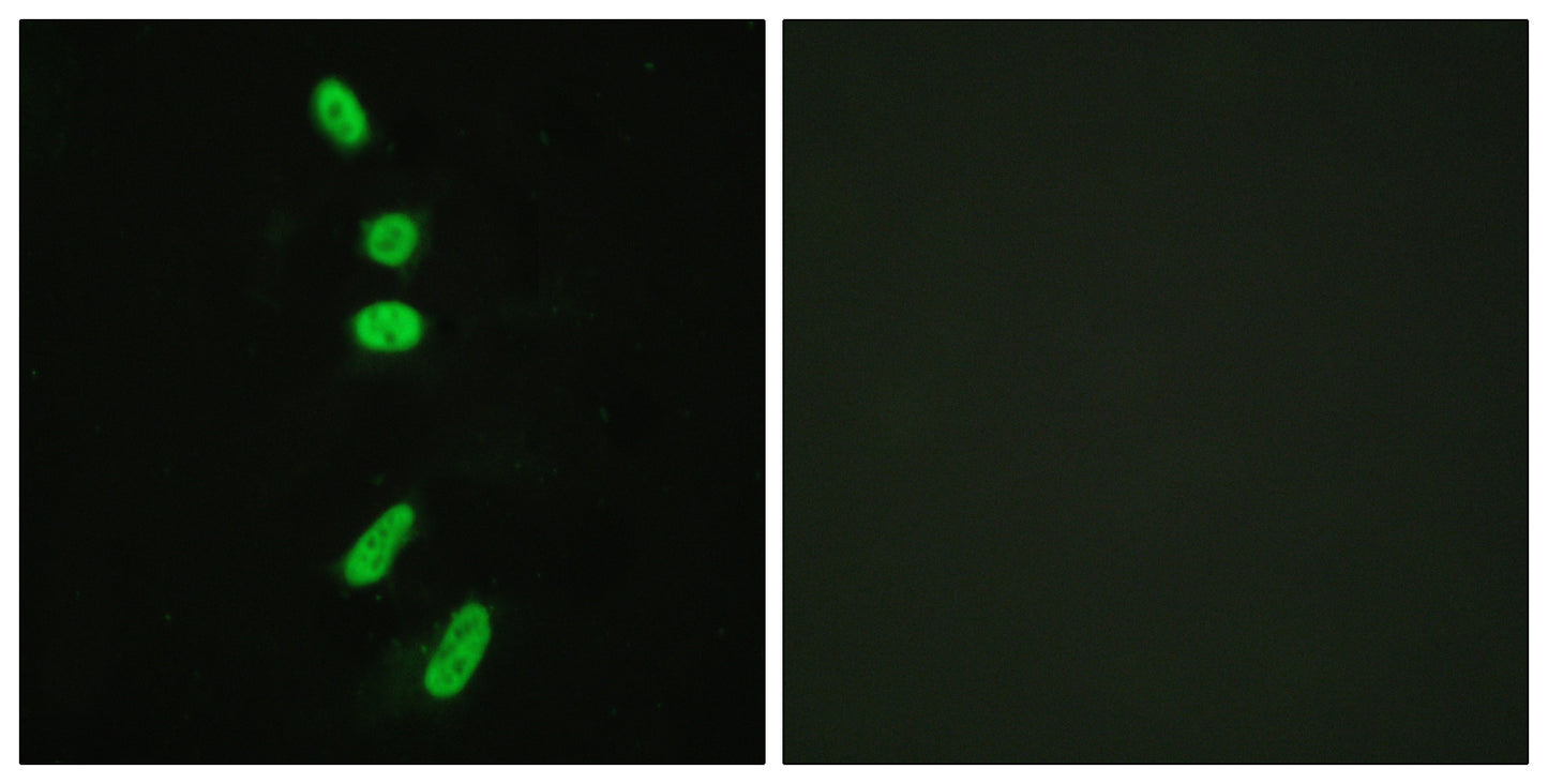 Splicing factor 1 Rabbit Polyclonal Antibody