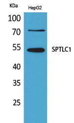 SPTLC1 Rabbit Polyclonal Antibody