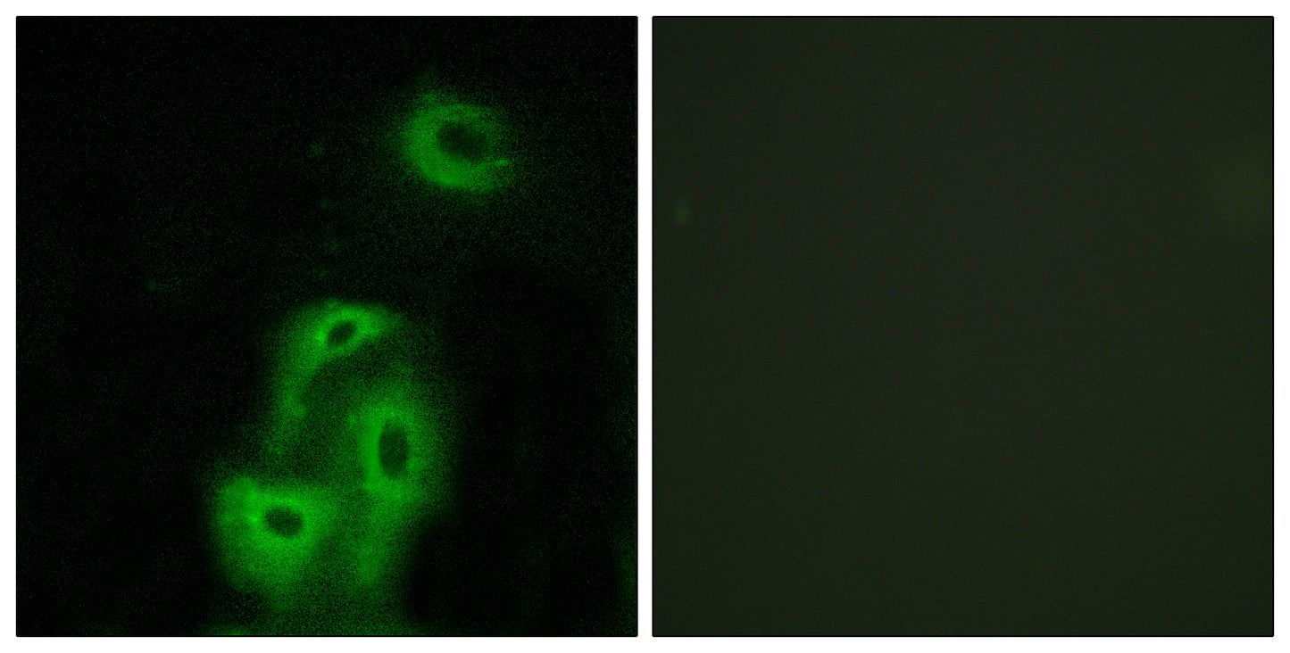 SR-2A Rabbit Polyclonal Antibody
