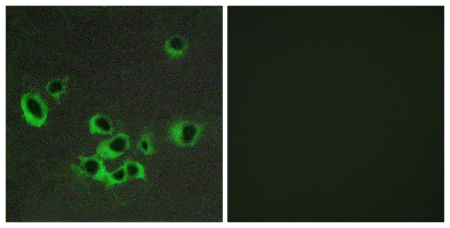 SR-2B Rabbit Polyclonal Antibody