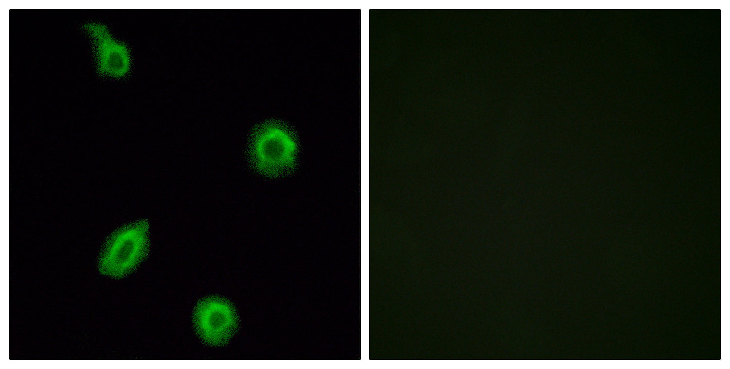 SR-5B Rabbit Polyclonal Antibody