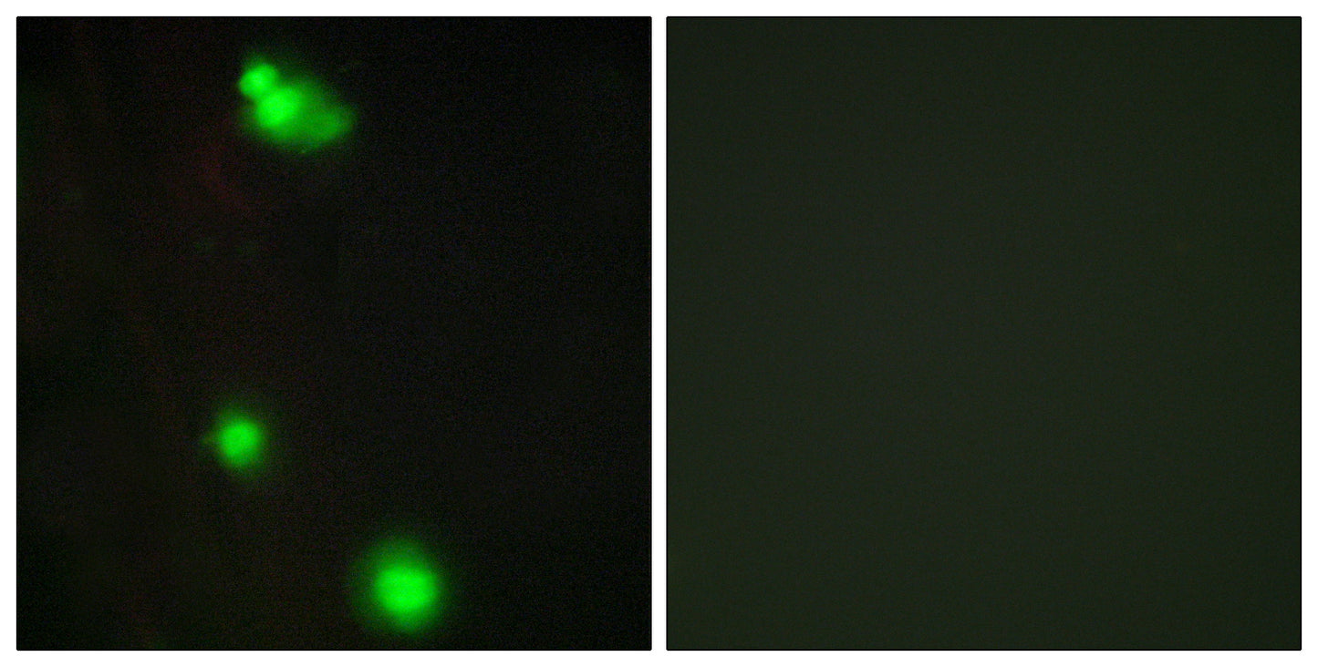 SRp20 Rabbit Polyclonal Antibody