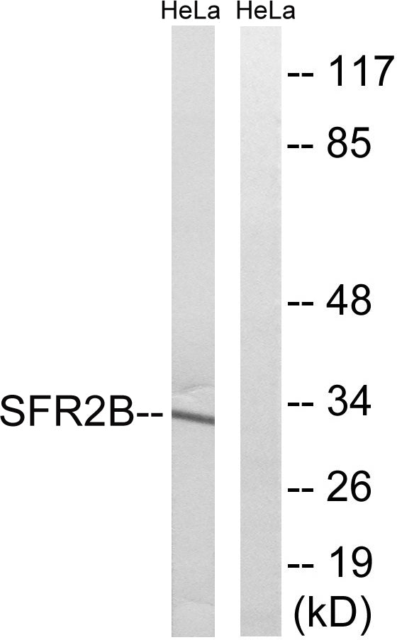SRp46 Rabbit Polyclonal Antibody