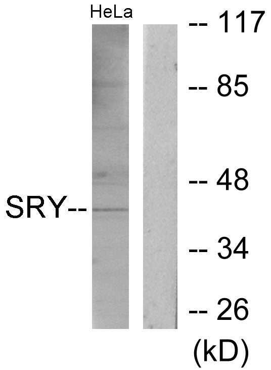 SRY Rabbit Polyclonal Antibody