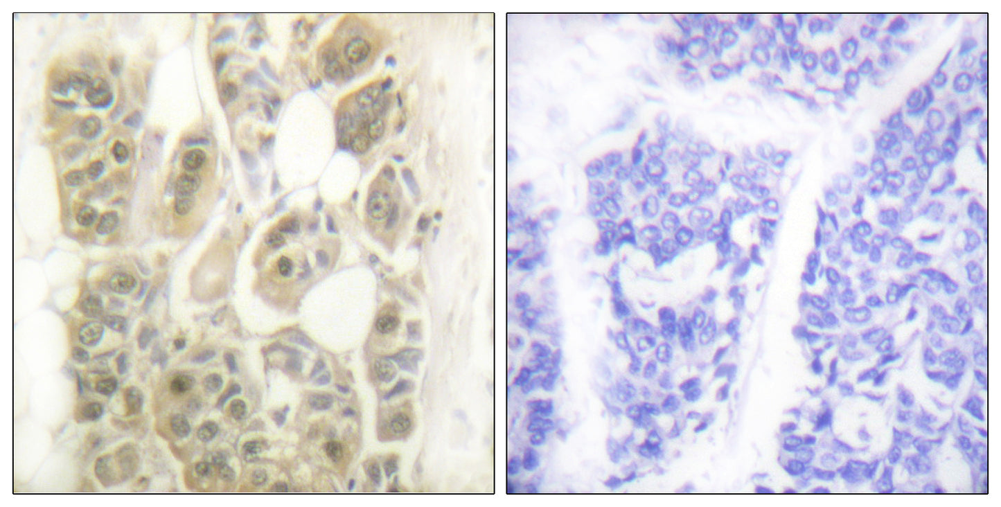 SSB Rabbit Polyclonal Antibody