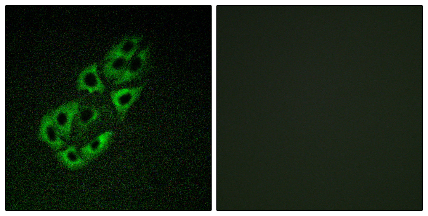 SSBP1 Rabbit Polyclonal Antibody