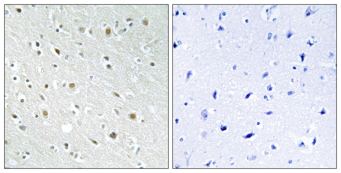 SSBP2 Rabbit Polyclonal Antibody